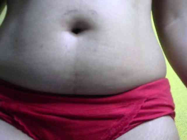 ricaah