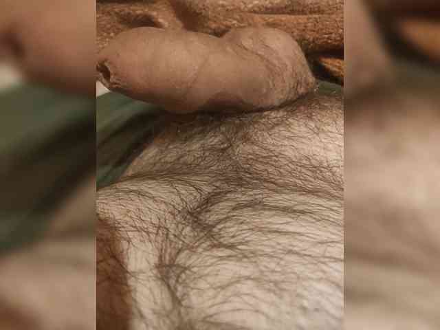 -Gold-dick-