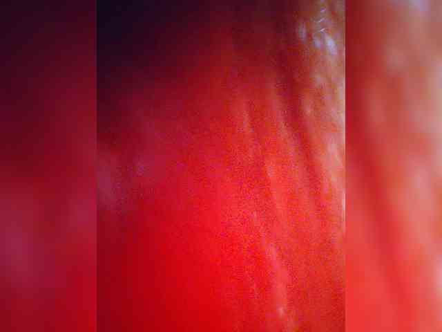 Kityteen webcam