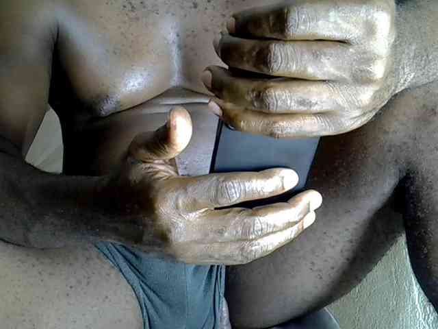 Africoc