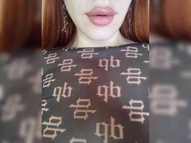 MEDOVAYA1 webcam
