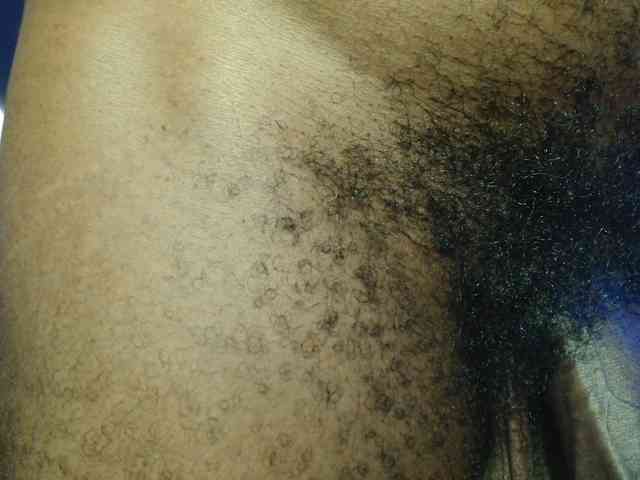 Taak_Diick
