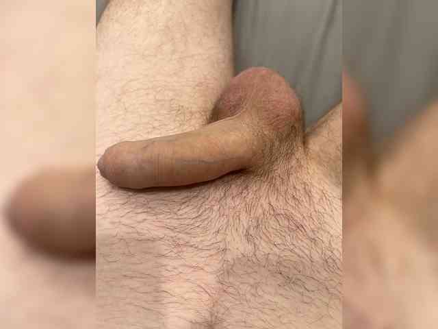 MRxx