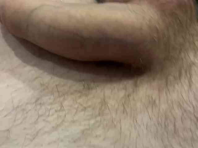 MRxx