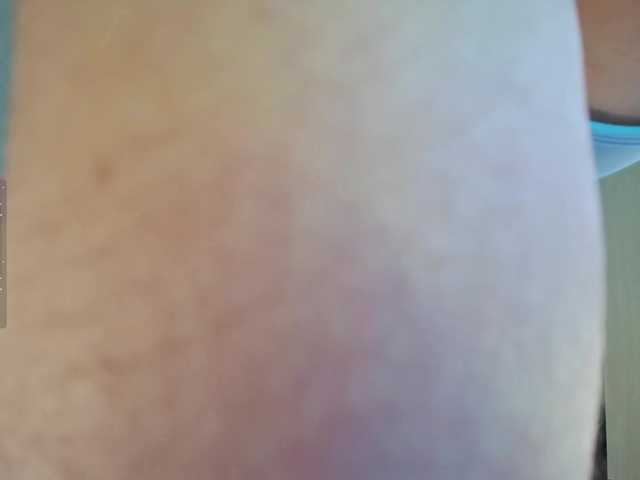 Rosea