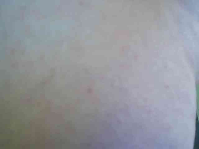 Rosea