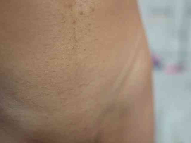 Beautifulskinny18 Beautifulskinny18