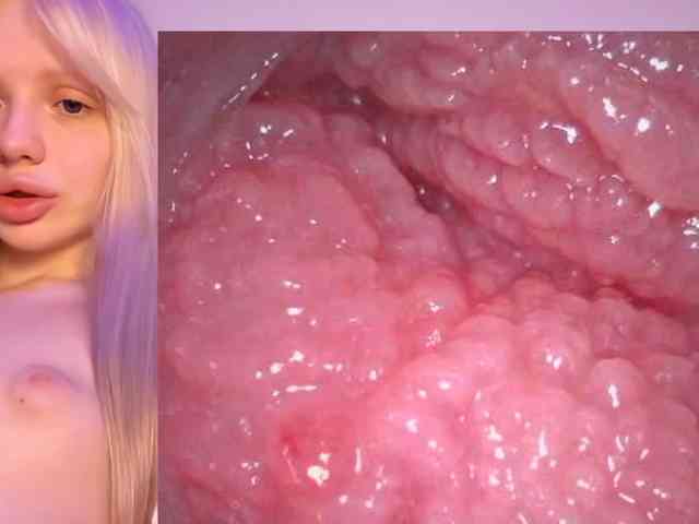 k1ss_me11