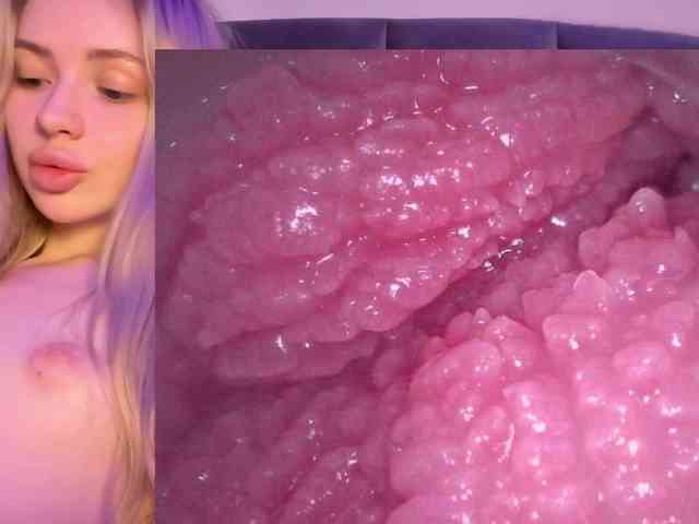 k1ss_me11