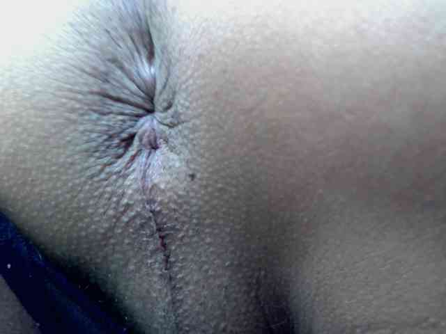 calioppe1