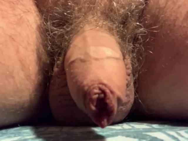 Ooooooops Ooooooops