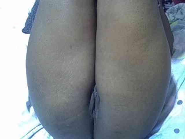 Hotmary01