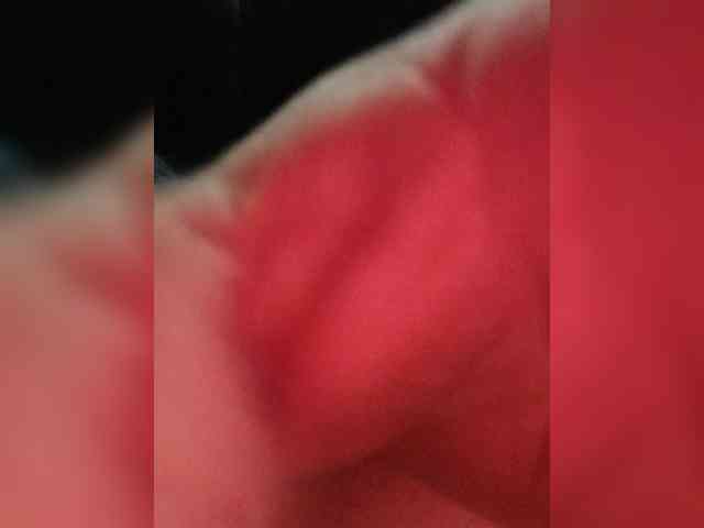 Matrixreakt