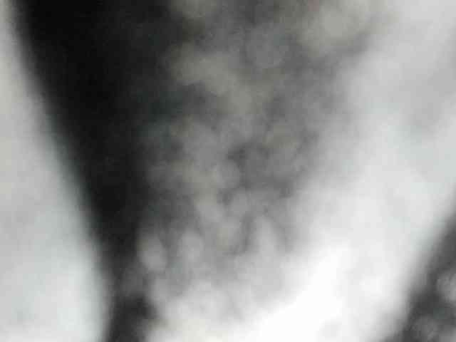 Arantza-Hill webcam