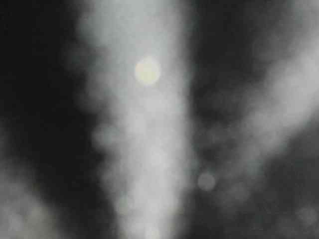 Arantza-Hill webcam