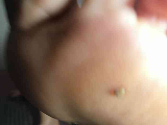 Arantza-Hill webcam