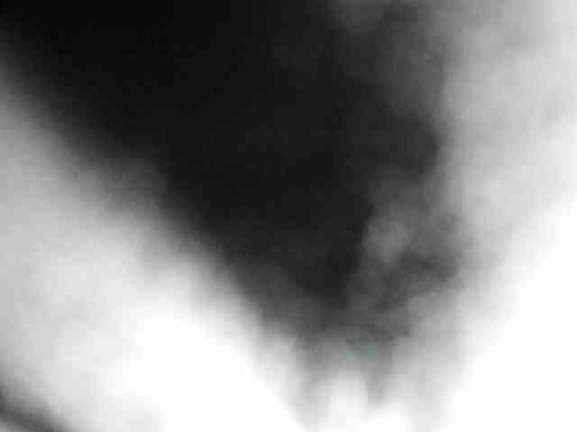 Arantza-Hill webcam