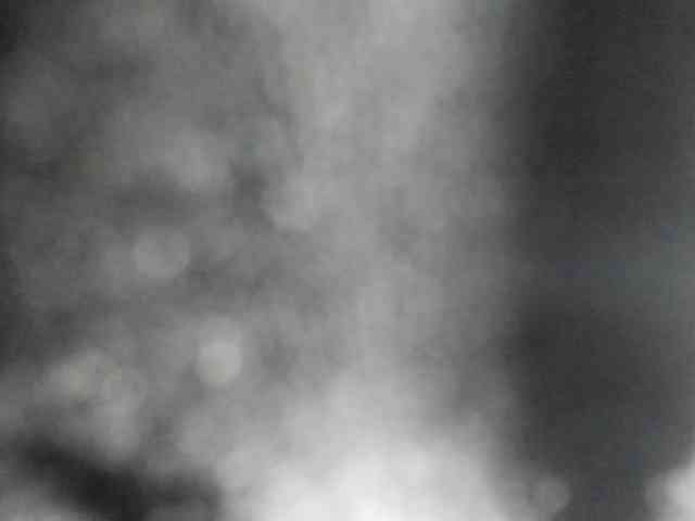 Arantza-Hill webcam