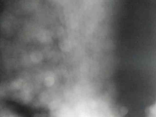 Arantza-Hill webcam