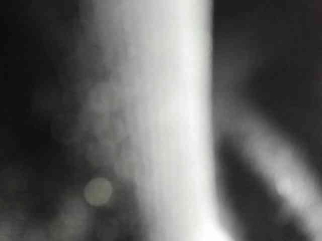 Arantza-Hill webcam