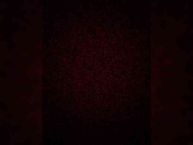 Patolog Sex Cam Show