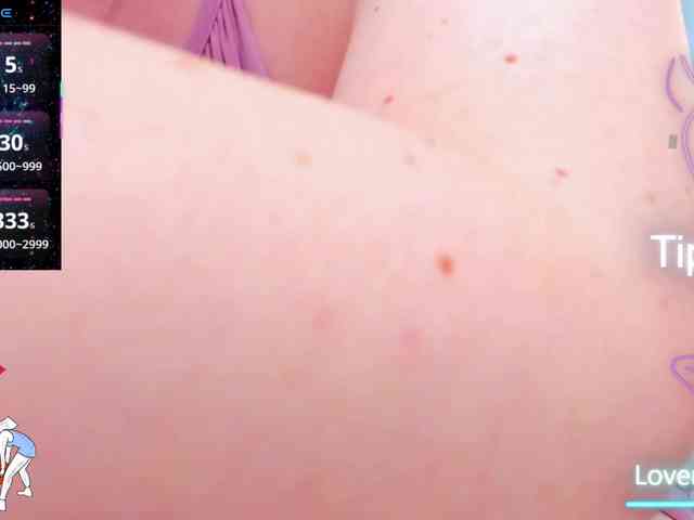 anyarosses