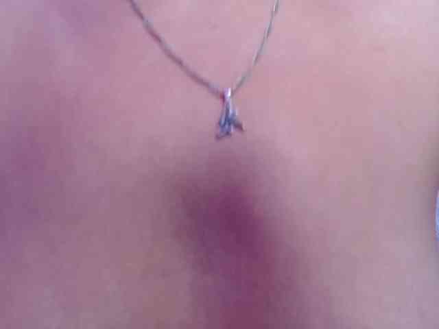 soy-abbyy