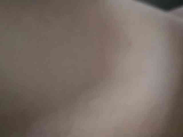 TBVSDR