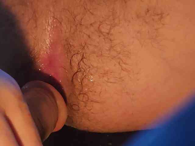 TBVSDR
