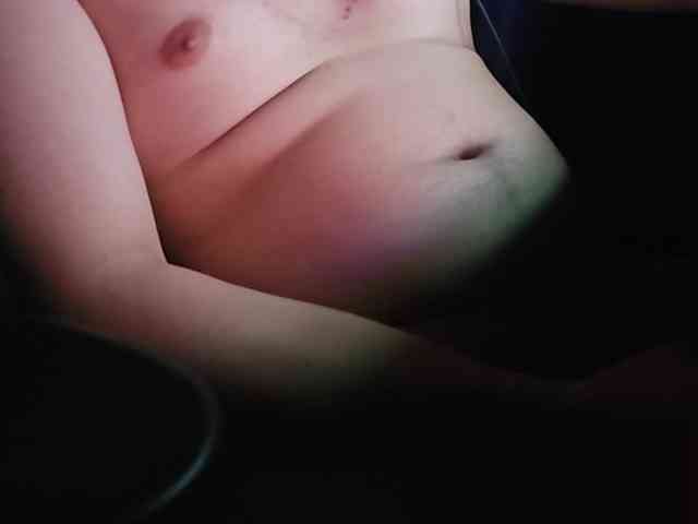 TBVSDR
