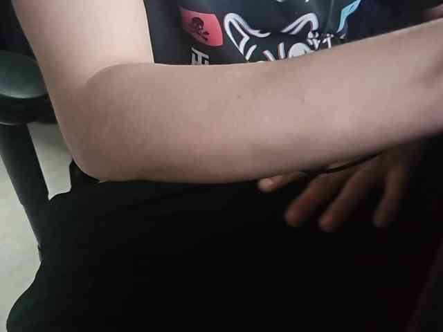 TBVSDR