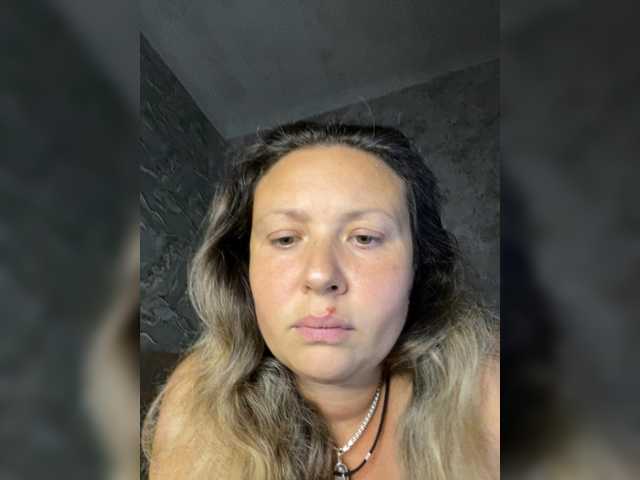 NERVOMOTINA