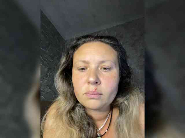 NERVOMOTINA