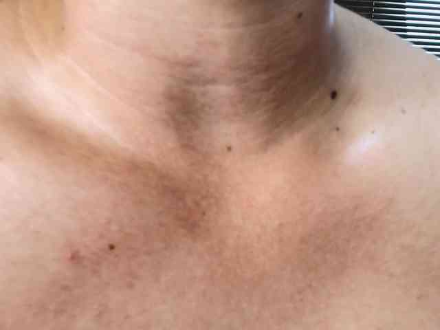 TommyJohn