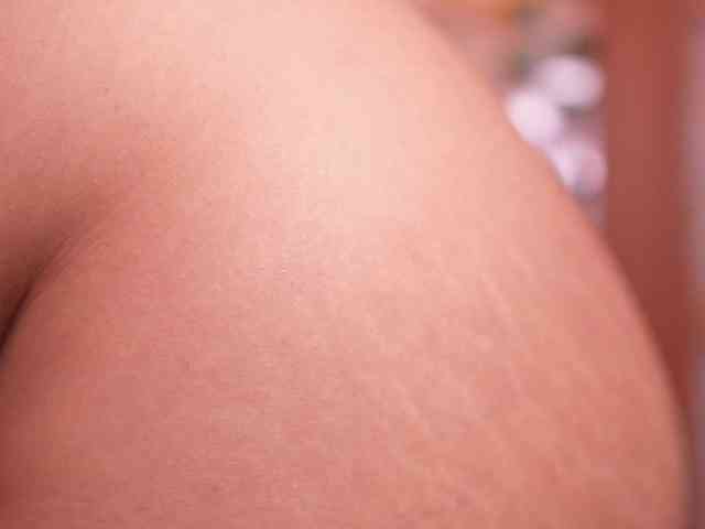 zoeyfox webcam