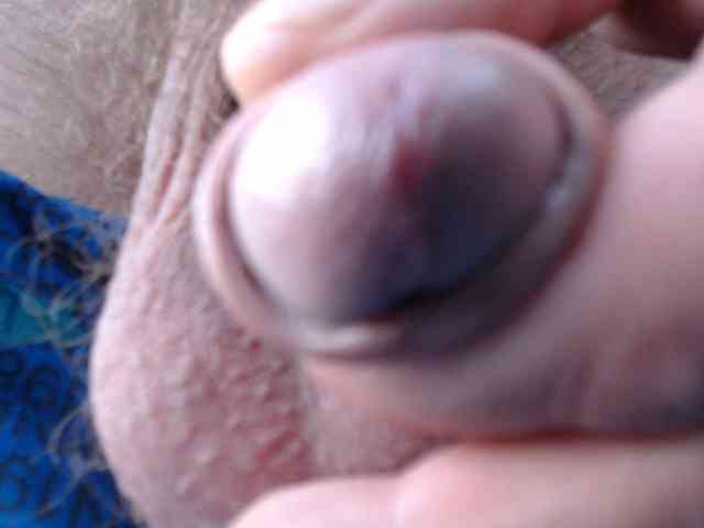 Alexilon