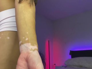 dalmatian-girl