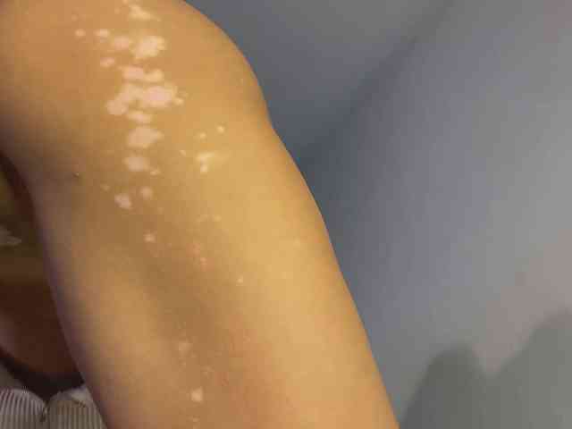 dalmatian-girl webcam