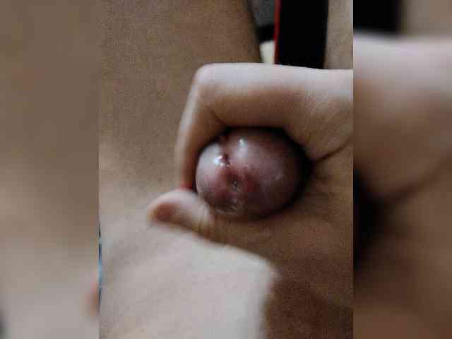 Glorbo-1