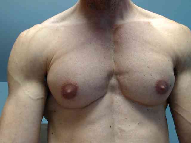 flexhard1 flexhard1