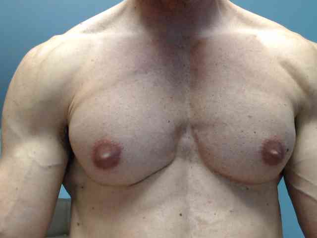 flexhard1