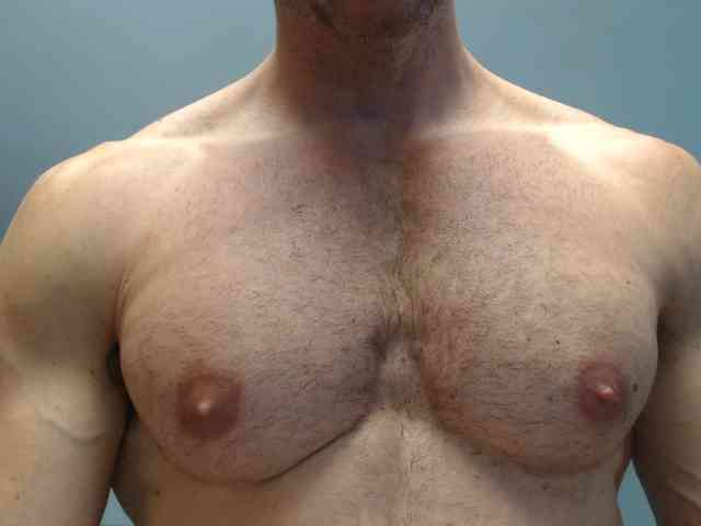 flexhard1