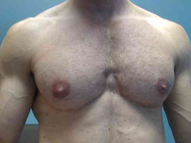 flexhard1