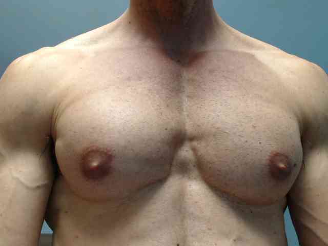 flexhard1
