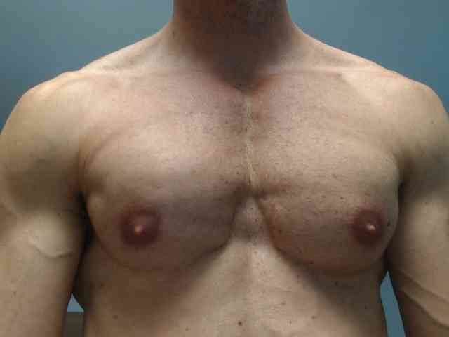flexhard1