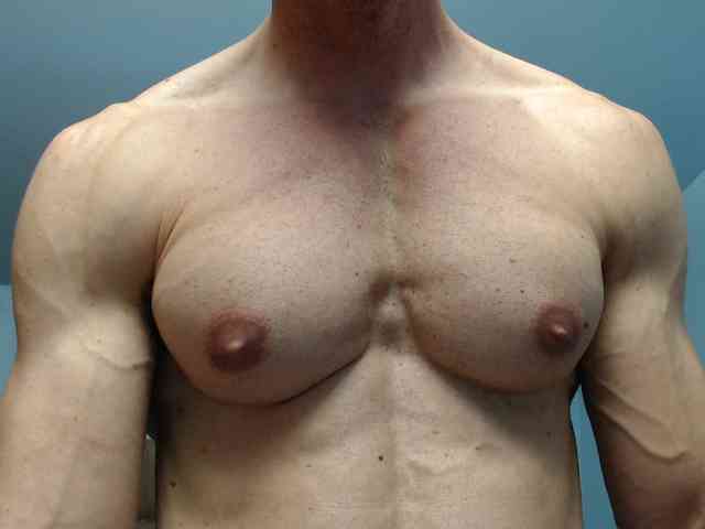 flexhard1