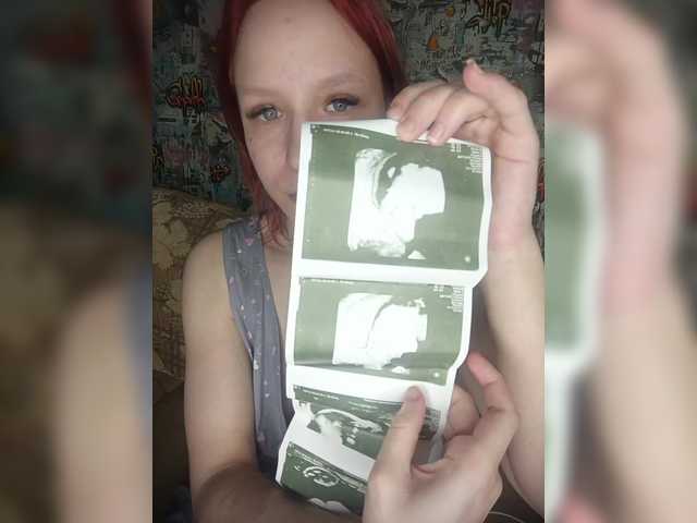 Preview of tpax-ha-tpax