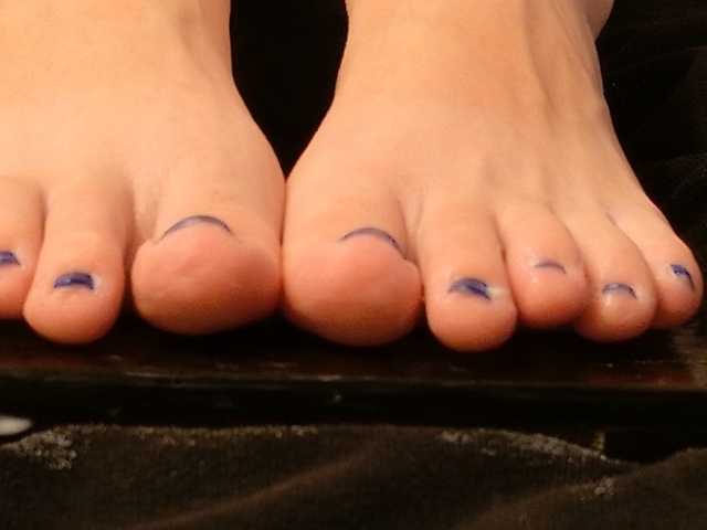Starfeet