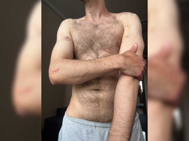 AnthonyDares