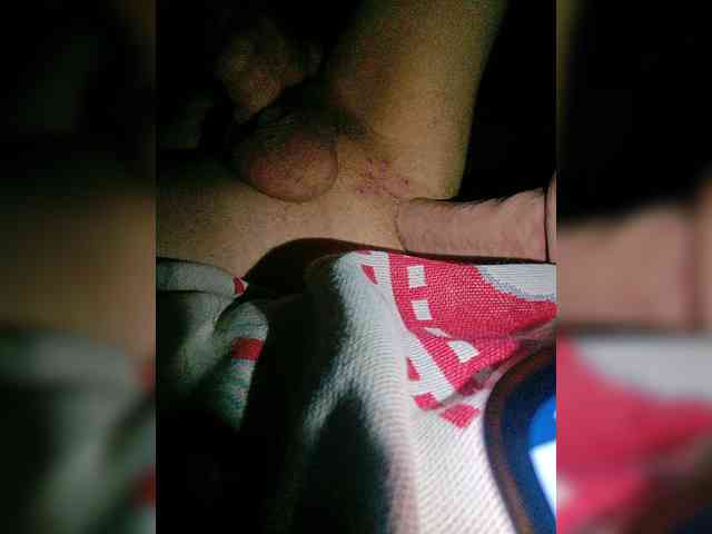 Anallhole